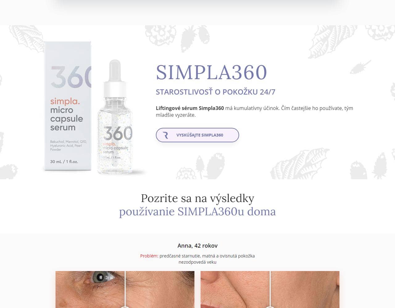 Simpla 360 4