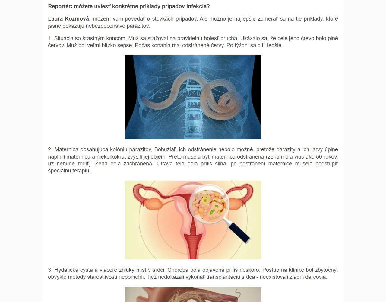 Vermixin 3